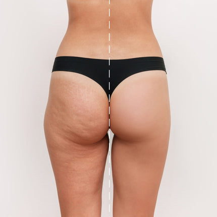 Brilliant Body Contouring - Rancho Cucamonga, CA